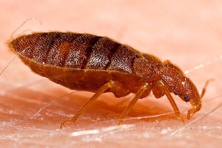 Karen McCann bed bug check hotel mattress Italy